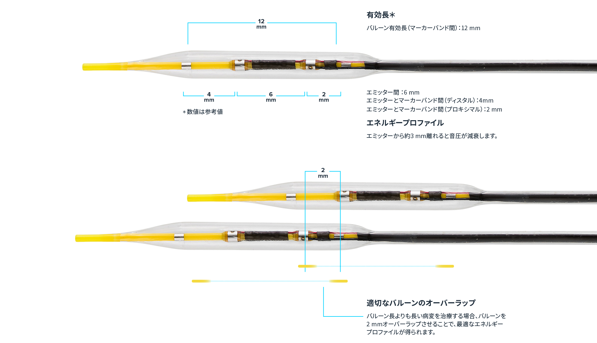 Shockwave C2 - Shockwave Medical Shockwave C2 - Shockwave Medical
