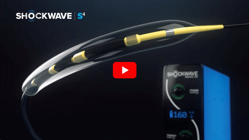 Shockwave S4 IVL Catheter | USA | Shockwave Medical