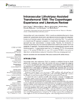 intravascular lith pdf