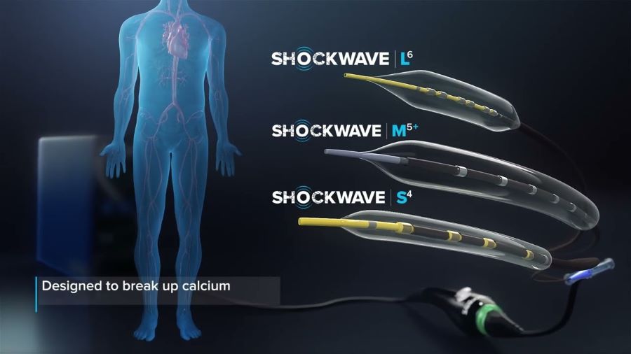 Shockwave Peripheral IVL Portfolio Catheters thumbnail