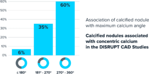 Bar chart showing the association of calcified nodules with maximum calcium angles based on the Disrupt CAD Studies. The chart demonstrates that calcified nodules are more frequently associated with concentric calcium at wider angles