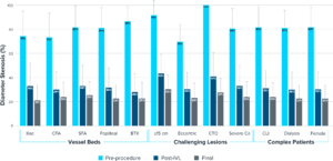 Bar chart showing diameter stenosis percentages across various categories before the procedure (Pre-procedure), after Intravascular Lithotripsy (Post-IVL), and at the final measurement (Final). The chart is divided into three main sections: 'Vessel Beds,' 'Challenging Lesions,' and 'Complex Patients.'