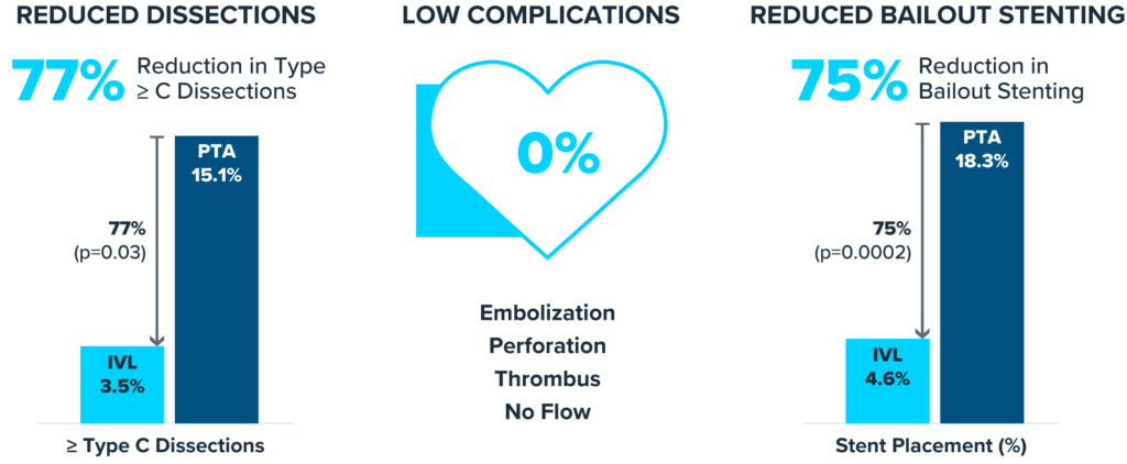 Three-part infographic showing the clinical benefits of Intravascular Lithotripsy (IVL) compared to Percutaneous Transluminal Angioplasty (PTA) in terms of reduced dissections, lower complications, and reduced bailout stenting.