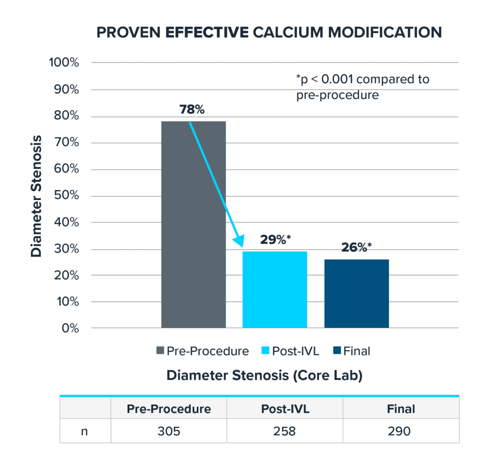 Bar chart illustrating the reduction in diameter stenosis across three stages: Pre-procedure at 78%, Post-Intravascular Lithotripsy (IVL) at 29%, and Final at 26%.