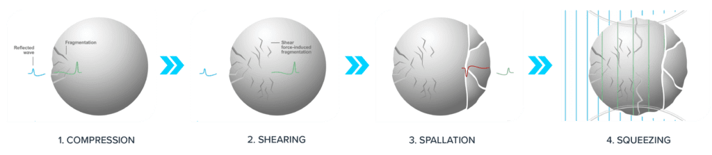 IVL Overview And MOA - Shockwave Medical