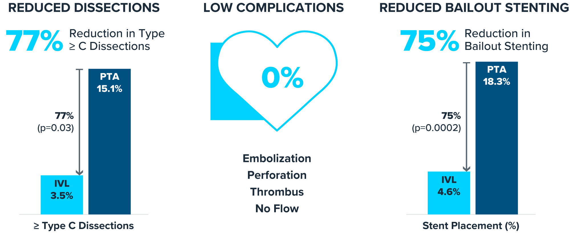 IVL Above The Knee Shockwave Medical