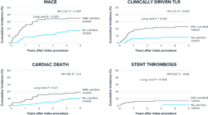 Four line charts comparing cumulative incidence of adverse cardiac events over five years between patients with and without calcified nodules. Each chart includes two lines: one for 'With calcified nodule' (gray) and one for 'No calcified nodule' (blue)