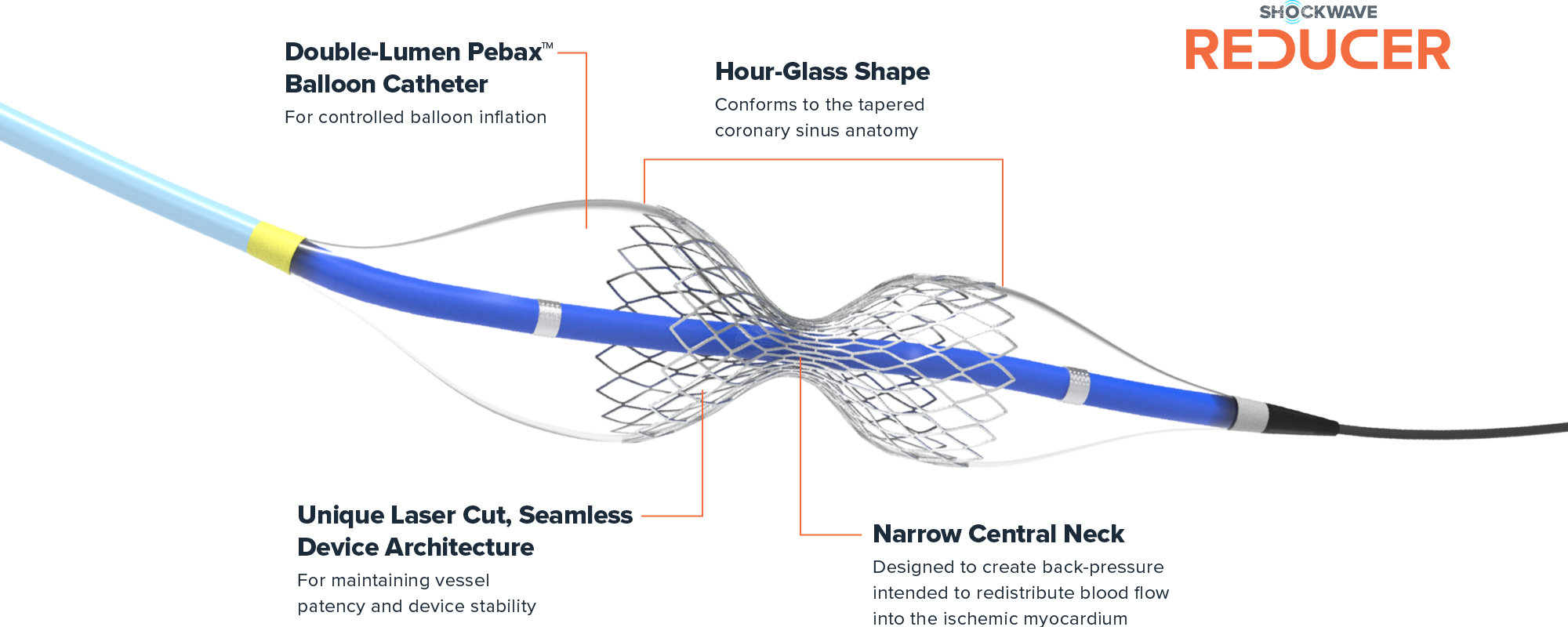 Digitally rendered image of Shockwave Reducer device showing the balloon catheter and the narrow central neck. 