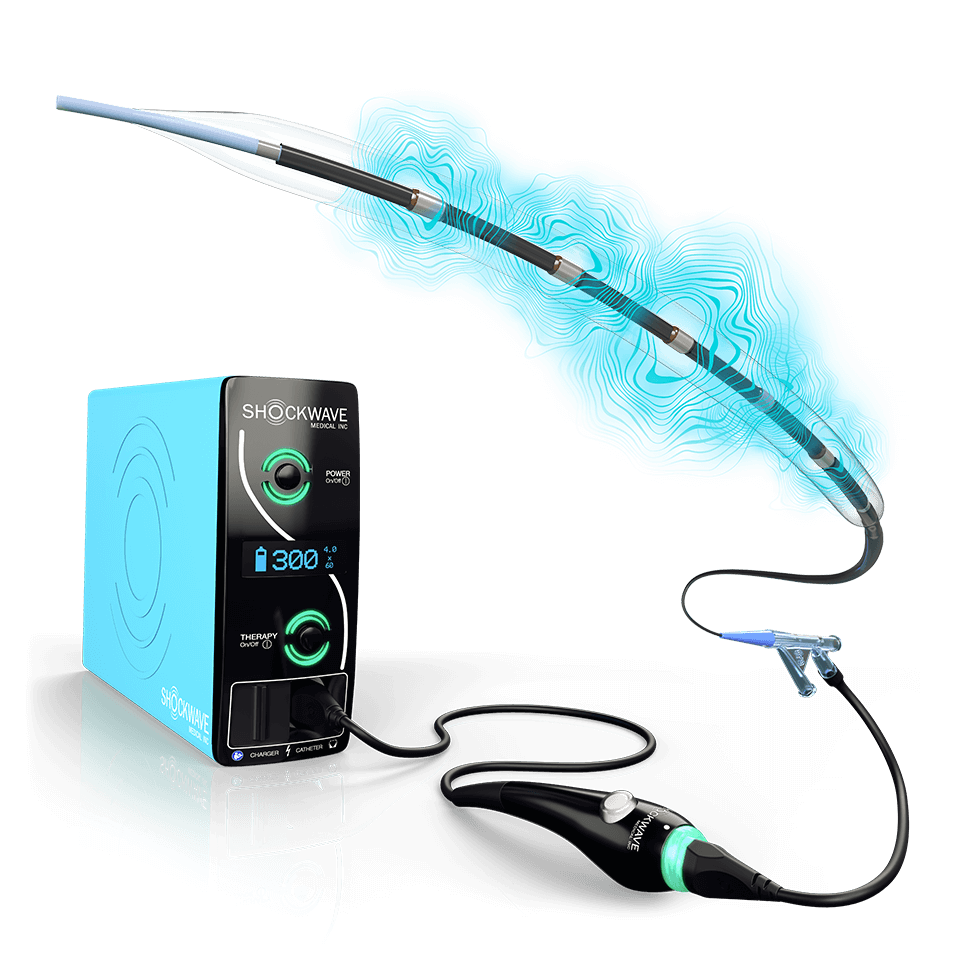 Digitally rendered image of Shockwave generator and catheter with blue pulses