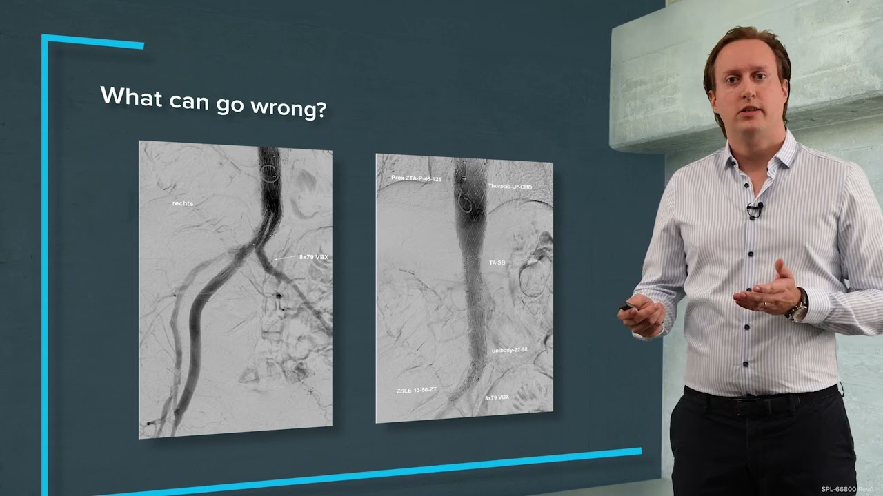 youtube thumbnail of professional talking what can go wrong in IVL treatment