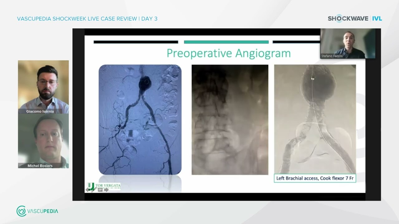 Youtube Thumbnail of professionals talking about preoperative angiogram