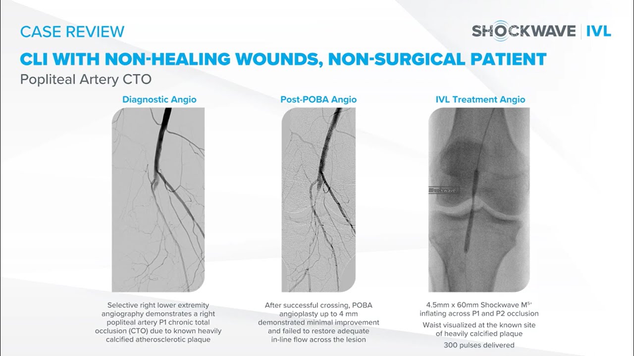 Video thumbnail featuring images of vessels