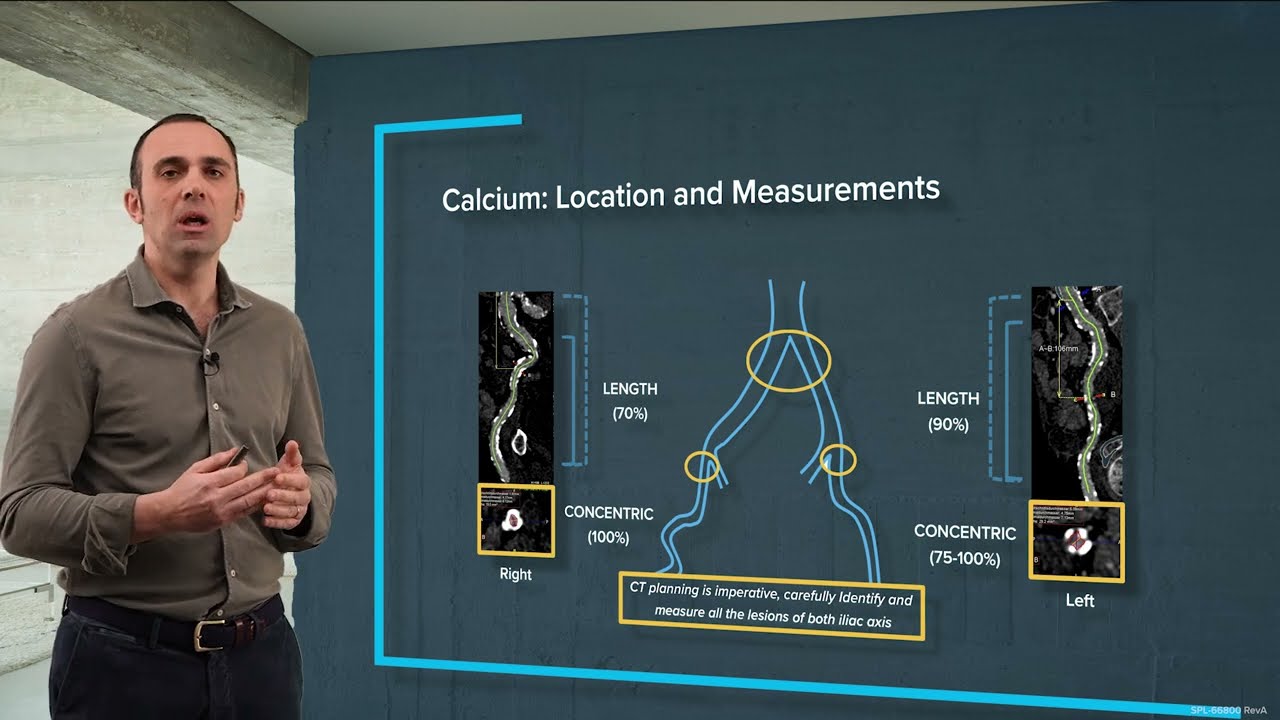 youtube thumbnail of professional talking about calcium location and measurements