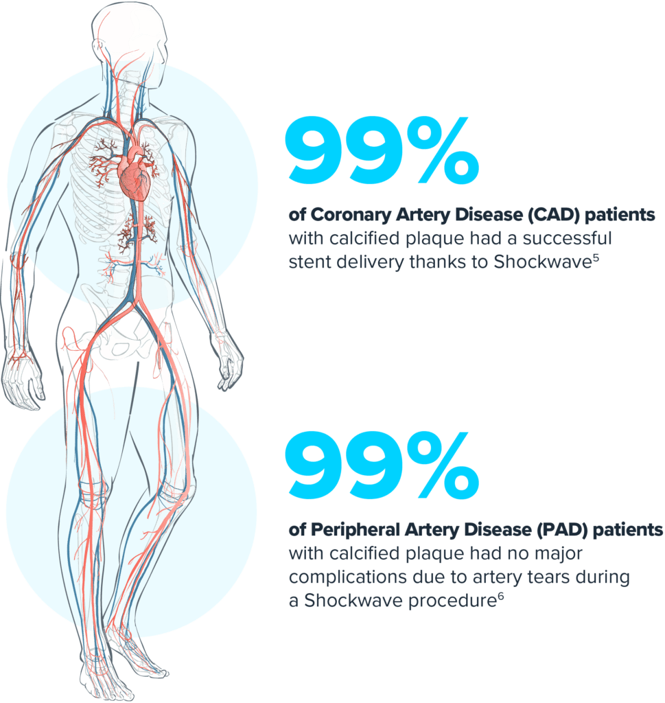 Illustration of a human skeleton with highlighted circulatory system showing arteries and the heart.