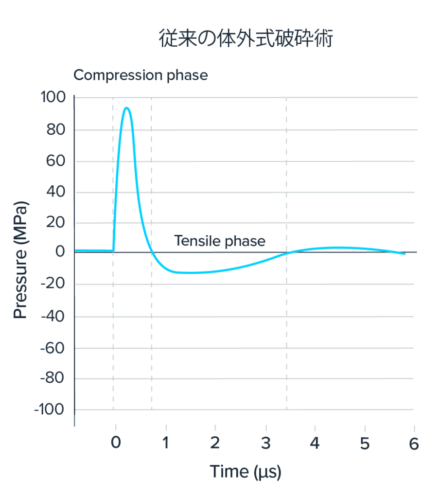 Graph depicting the standard lithotripsy waveform, showing pressure (MPa) on the vertical axis and time (microseconds, µs) on the horizontal axis
