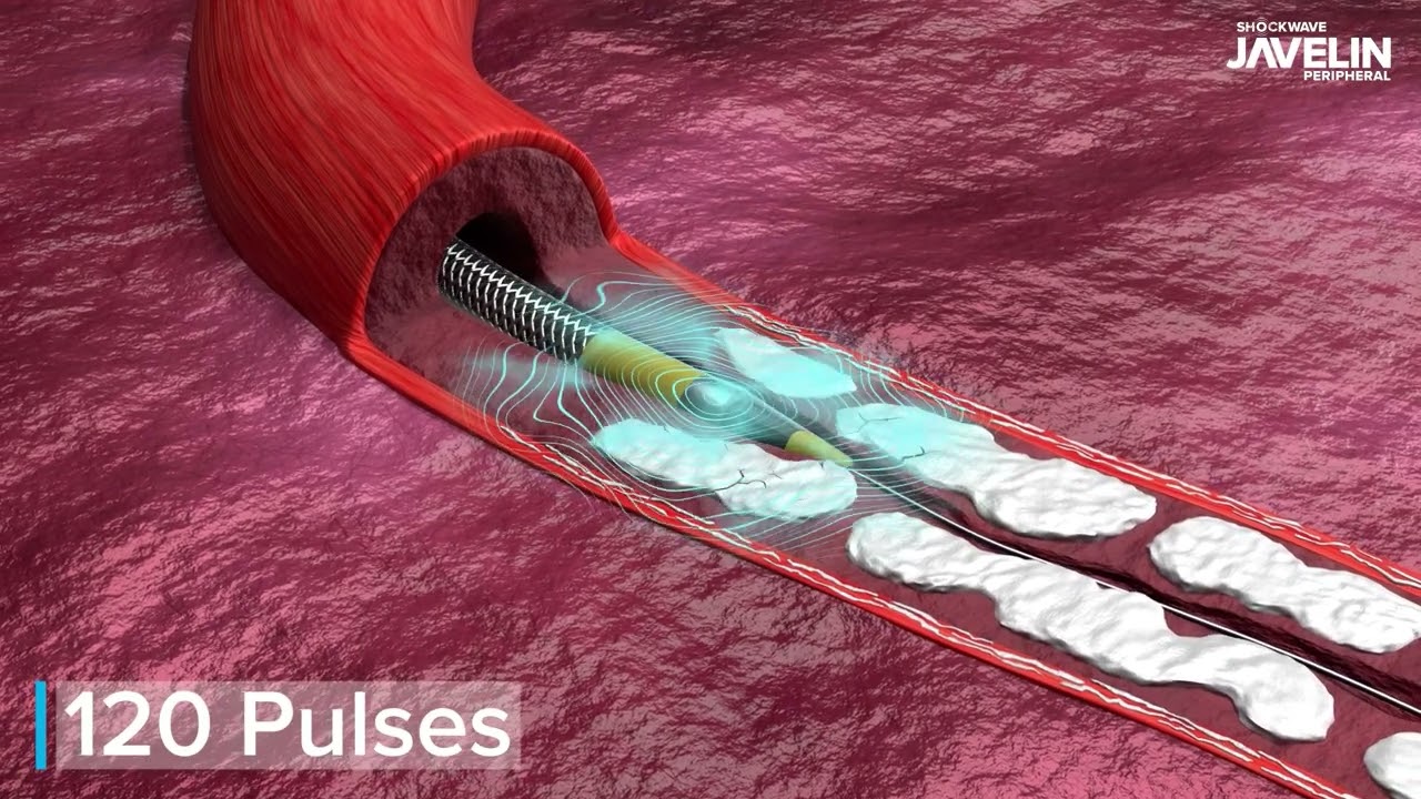 Shockwave Javelin Peripheral Animation