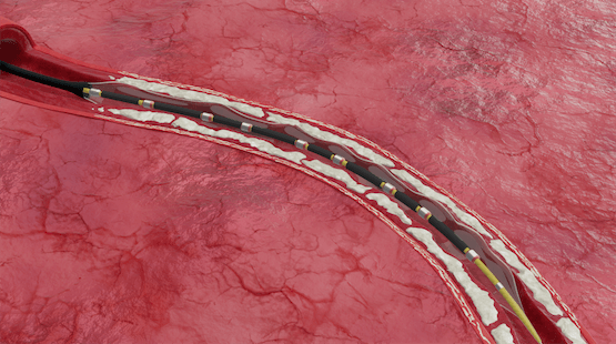 Image for Position & inflate