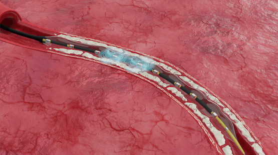 Image for Deliver Shockwaves