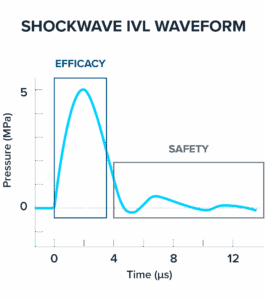 Line chart graphic illustrating the waveform of Shockwave IVL, with the high-amplitude positive peak pressure driving efficiency to maximize compressive stress for calcium modification, while the extended duration (low amplitude) negative peak pressure drives safety, minimizing soft tissue damage due to tensile strength