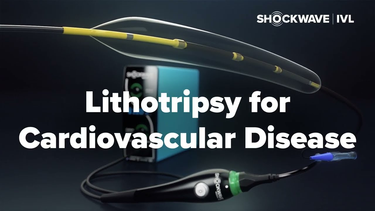 Lithotripsy for Cardiovascular Disease: Mechanism of Action