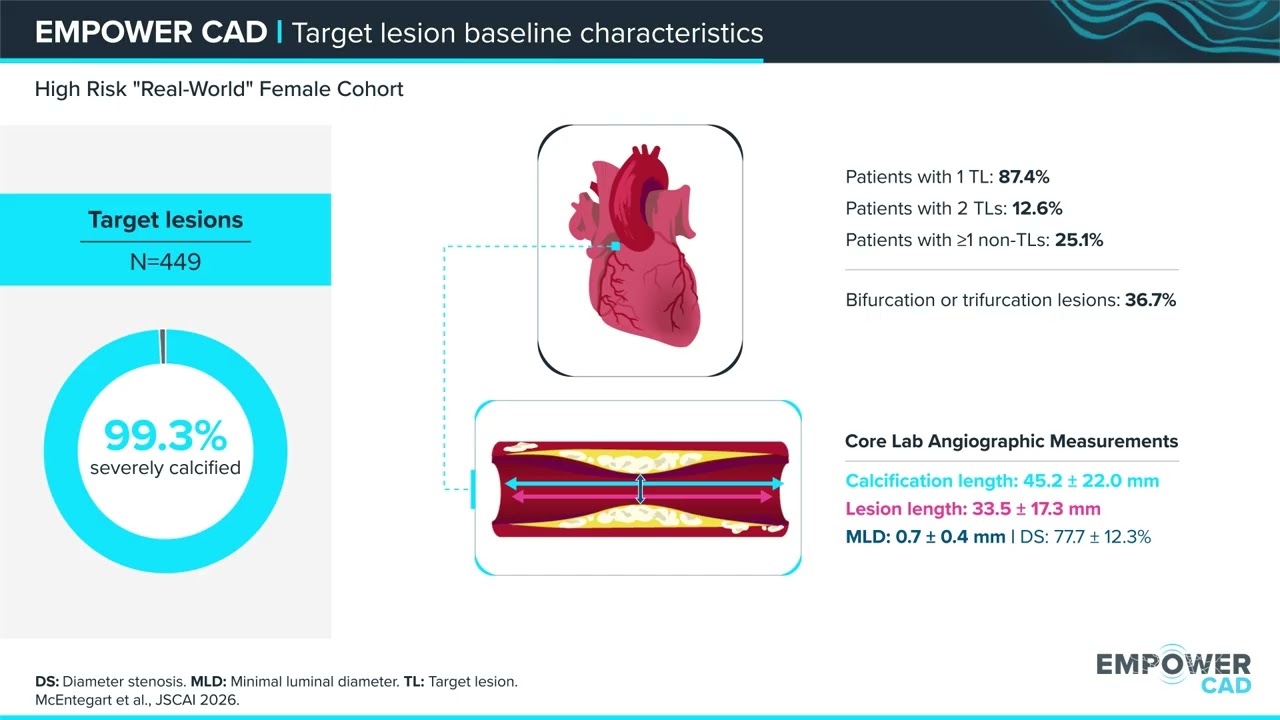 Real-world Data Empowers Benefits of IVL-first Strategy Confirmed in Females