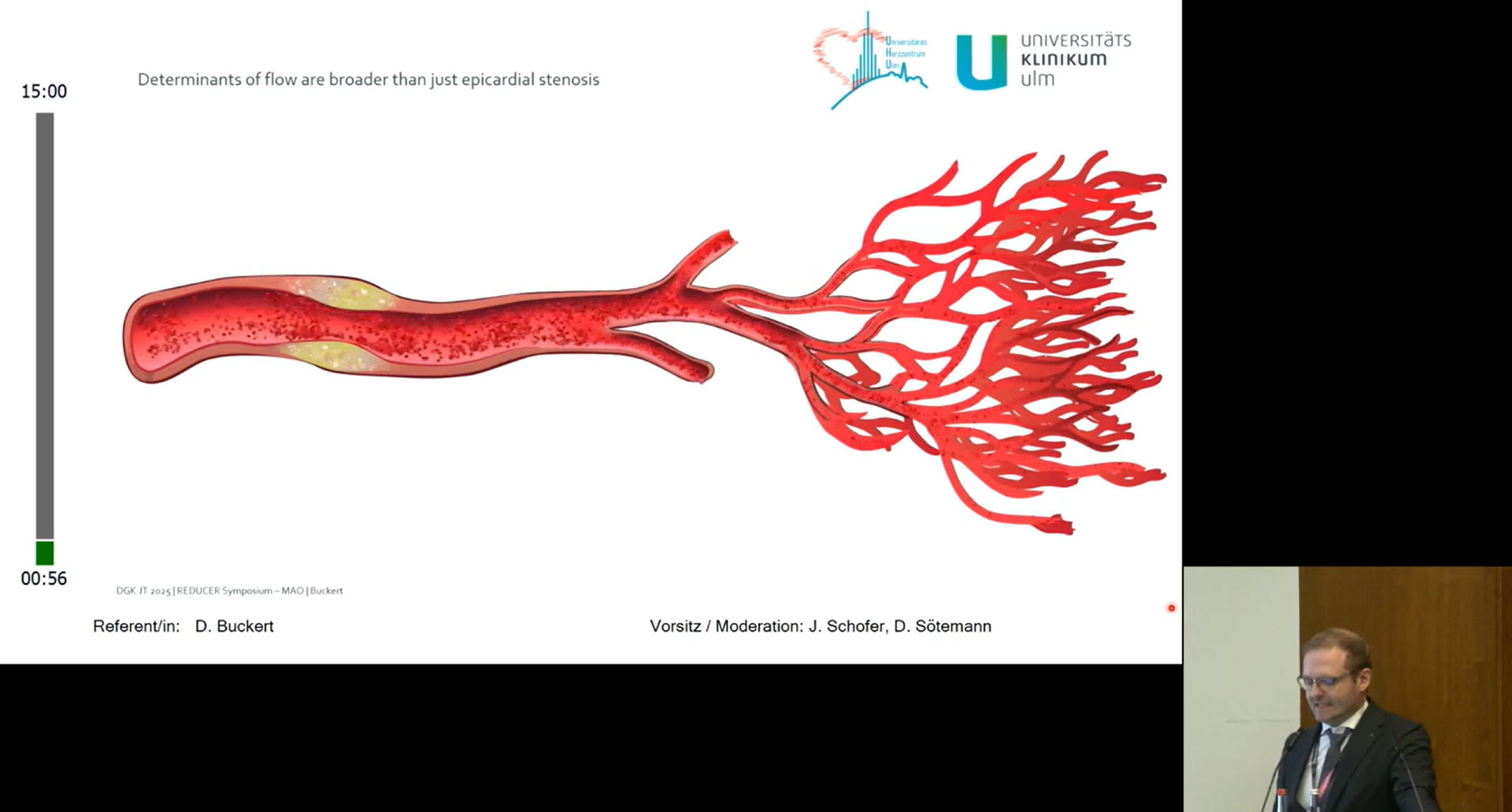 DGK 2025 Symposium: Shockwave Reducer Wirkungsweise (MOA) (in deutscher Sprache)