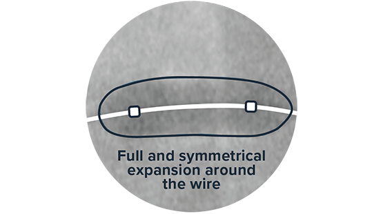 Image for Adequate Compliance: Symmetrical Balloon Expansion