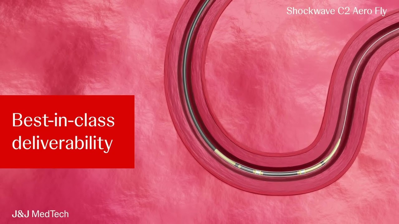 Shockwave C2 Aero Fly | Johnson & Johnson Circulatory Restoration